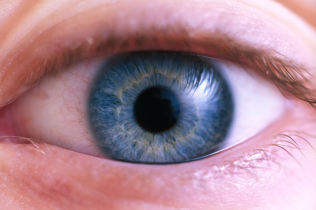 In Schizophrenia and Bipolar Disorder, Life Isn't Black and White