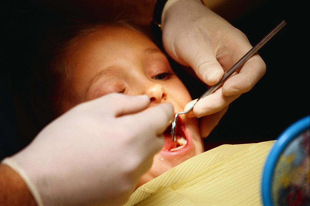 Obesity & Inflamed Gums Linked