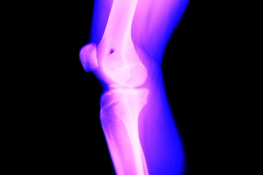 Quicker Recovery for Your Knee