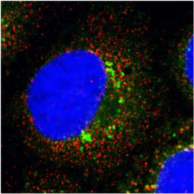 Liver Cancer Going Viral