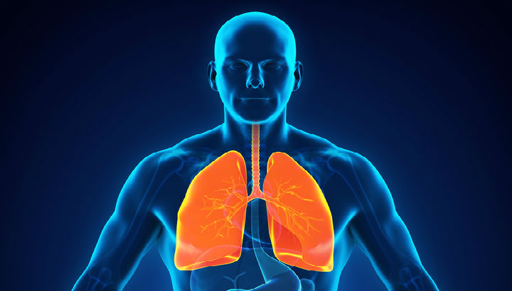 FDA Approves Device for Emphysema