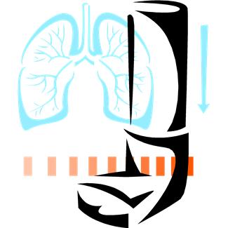 COPD Treatment a Clinical Trial Success