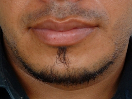 Men More Oral Than Women