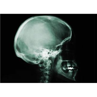Head and Neck Cancer Presentation Highlights