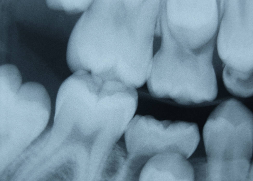 More Dental Check-ups Better Than Fewer