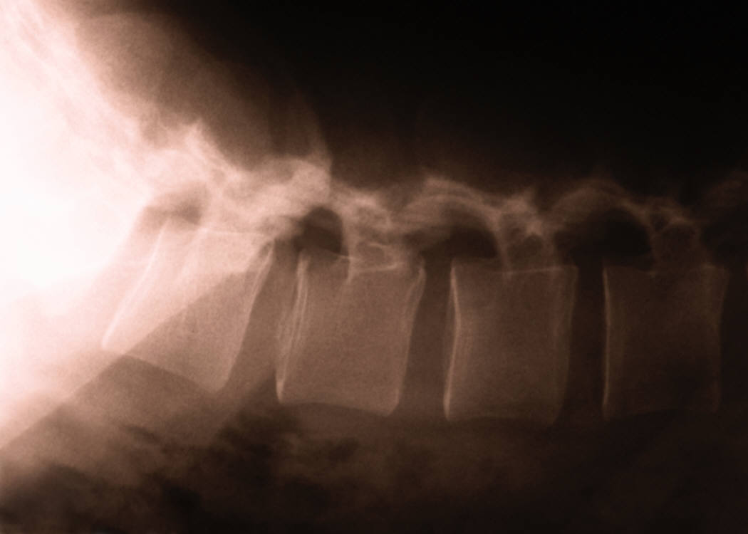 Bone Loss Rx May Slow Bone Growth