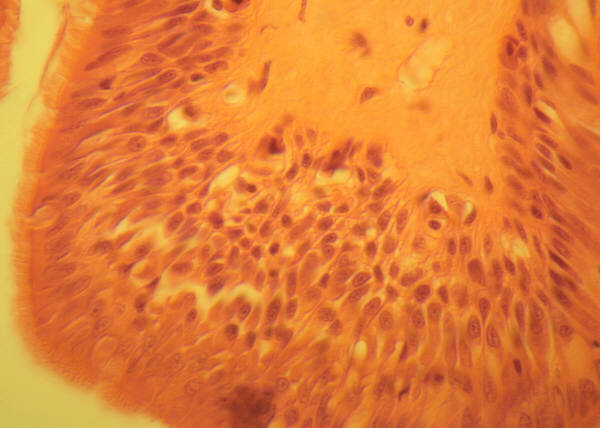 The Birds and the Bees...and Fungi
