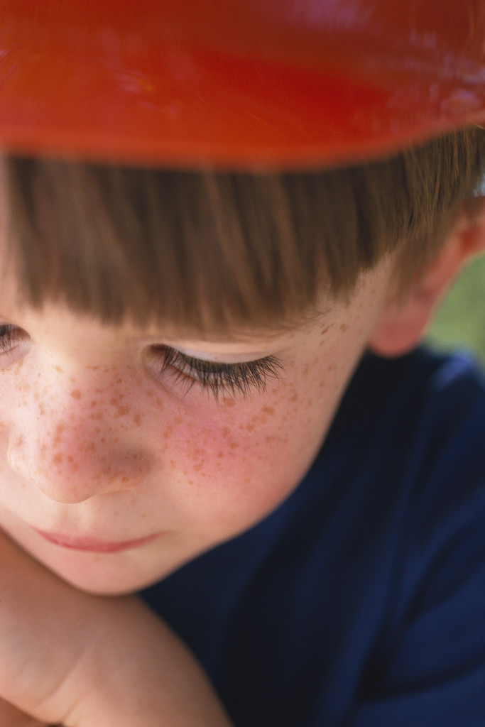 Autistic Brains Show Big Differences