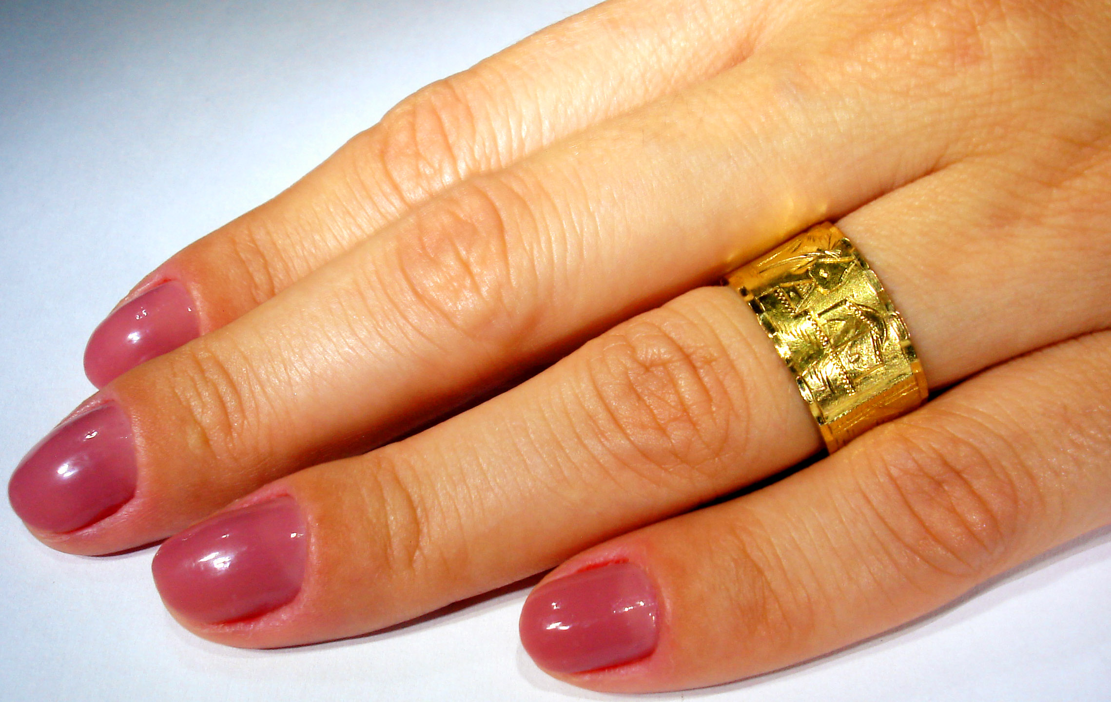 When Nail Polish Doesn't Work