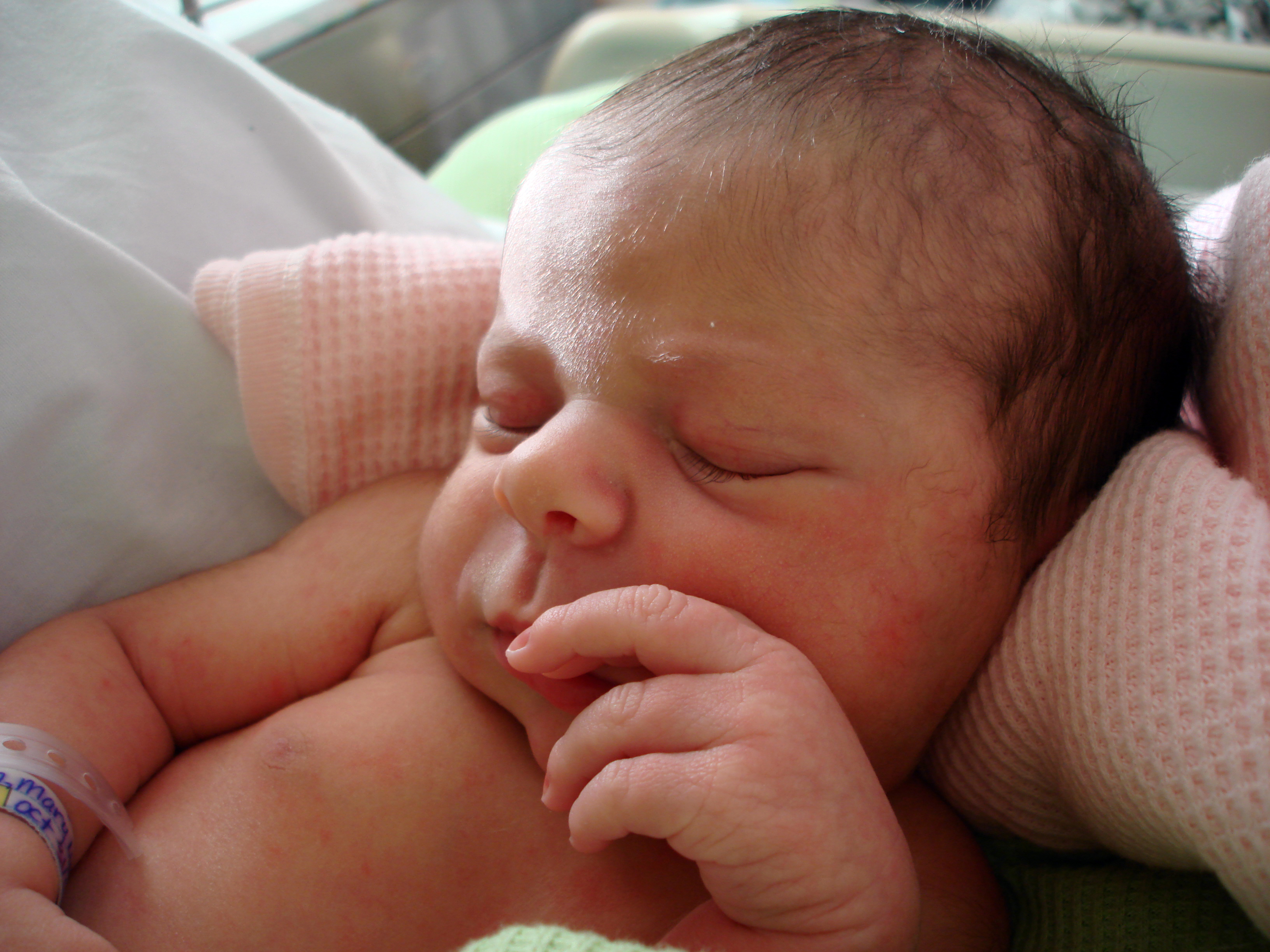 Surgery Before Birth Improves Outcomes