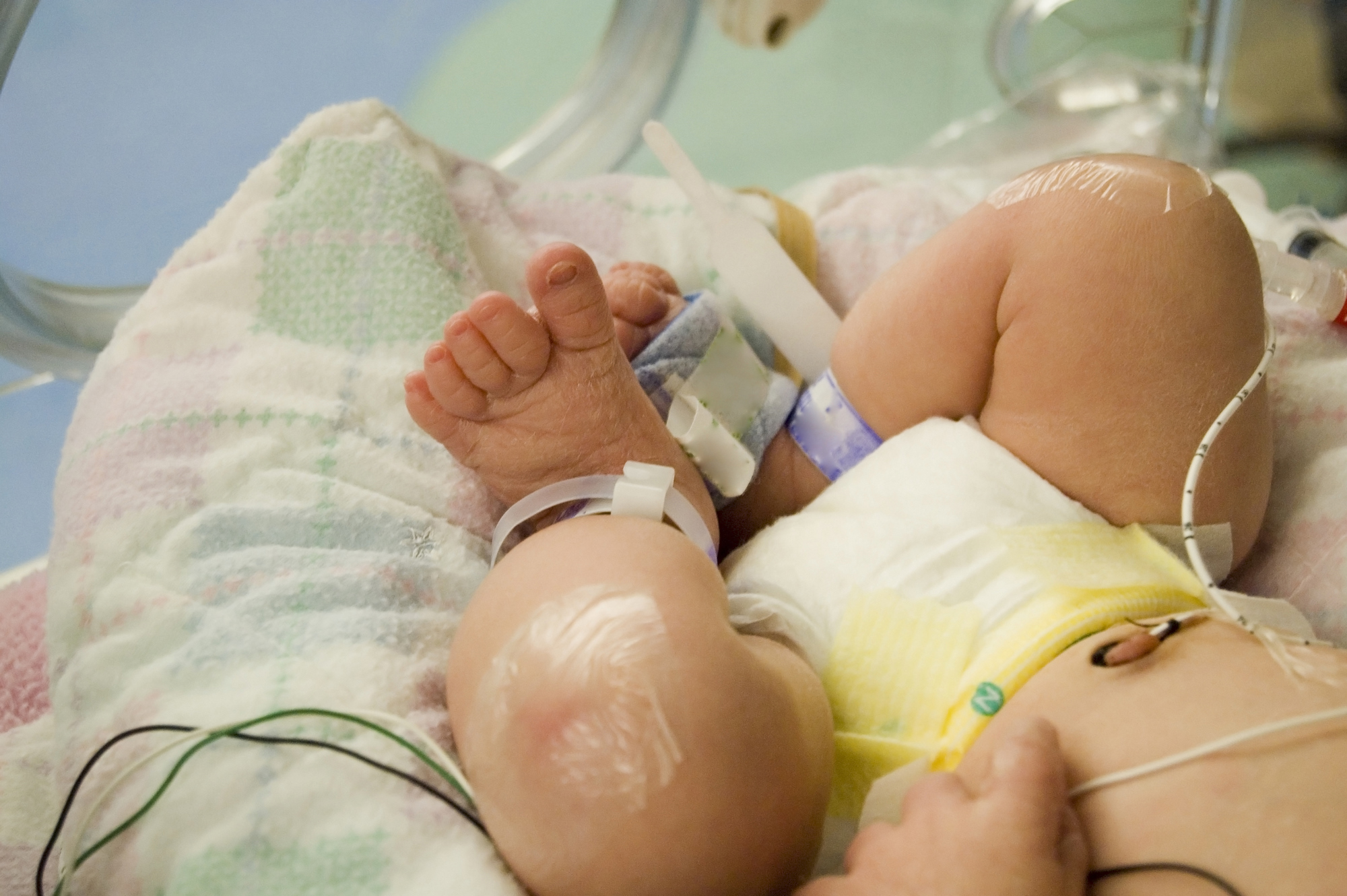 Optional Early Baby Delivery Rates Drop