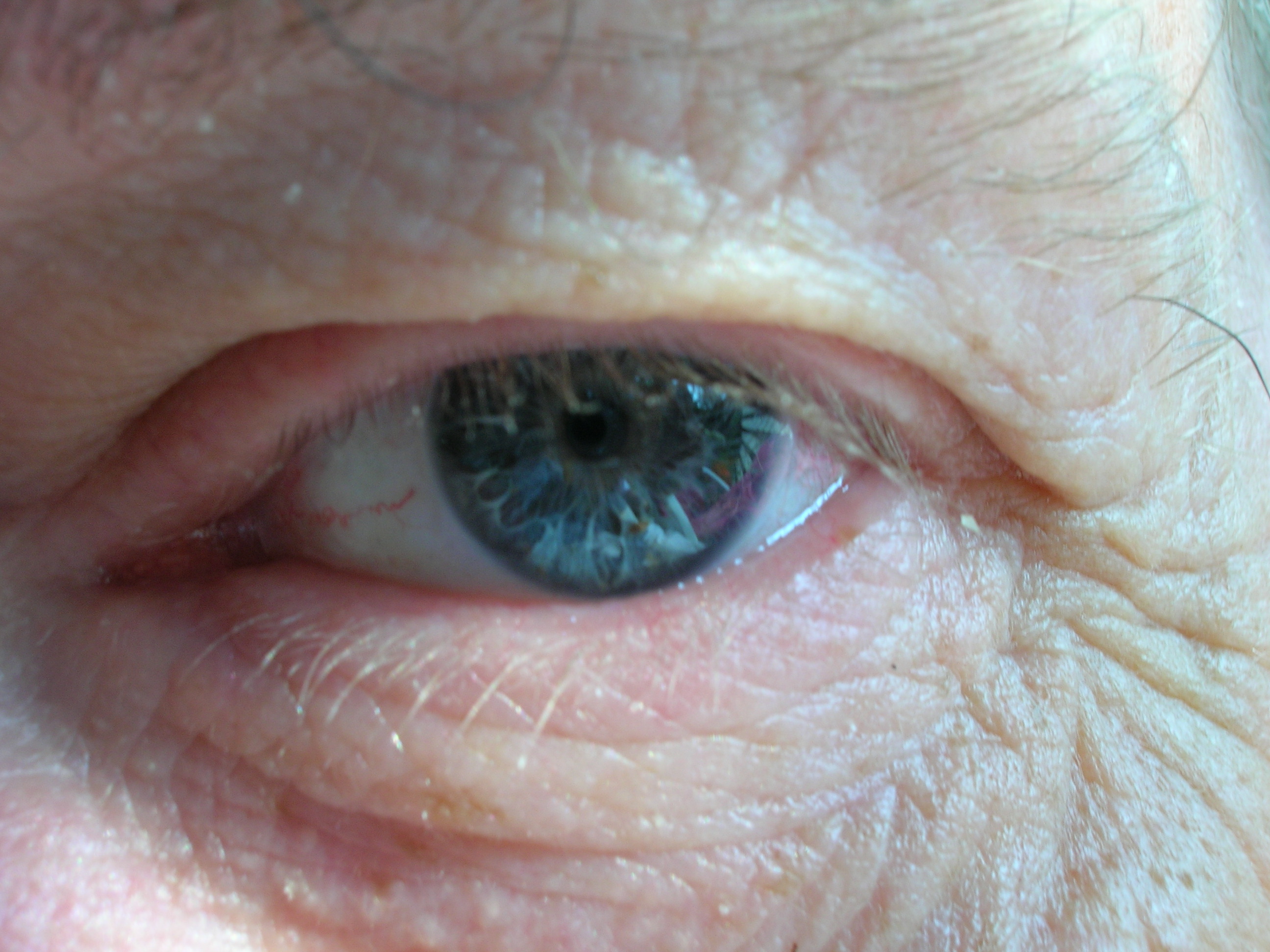 With an Eye to Your Homeland