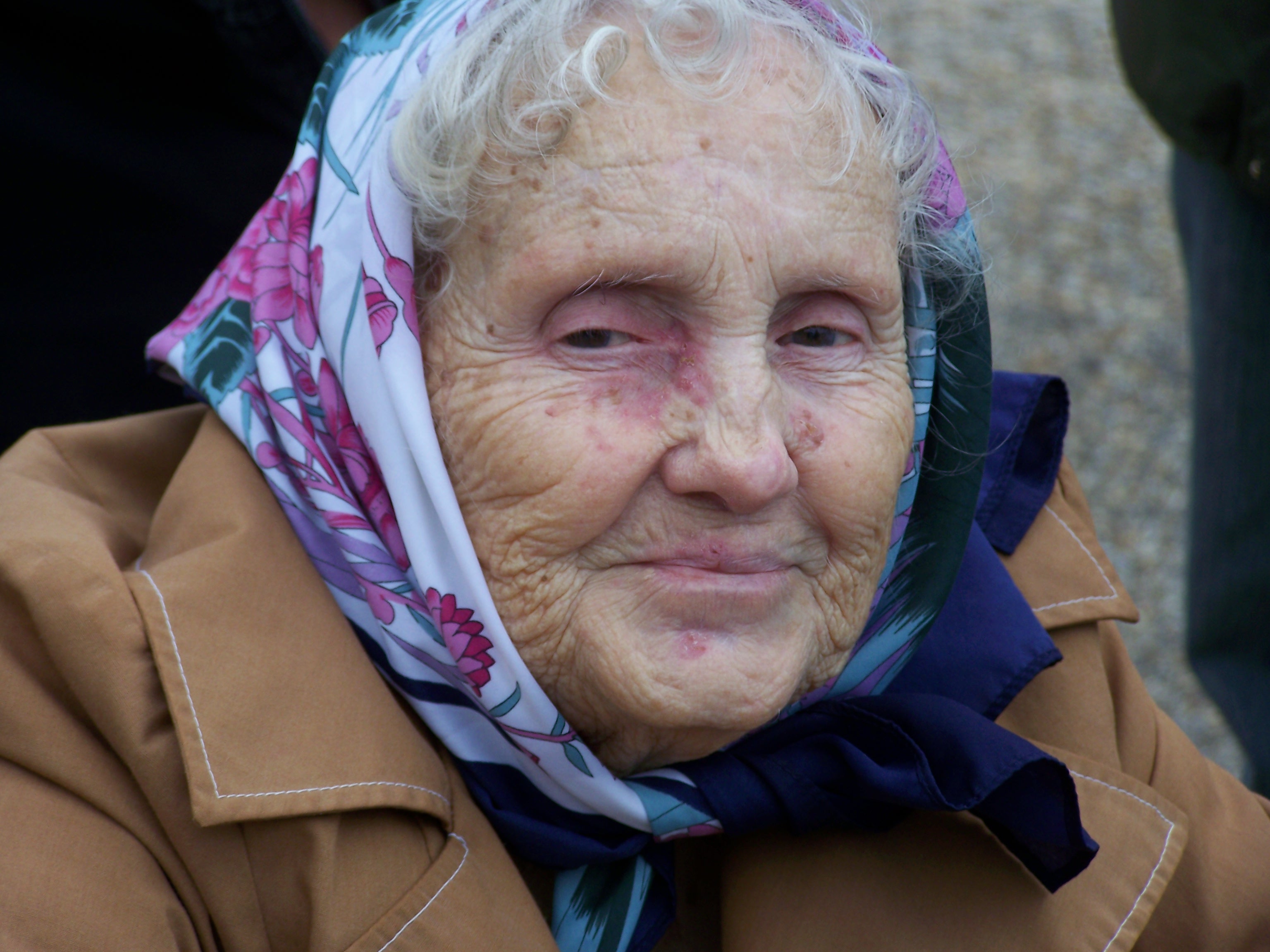 Alzheimer's Affects Genders Differently