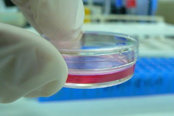 Promising new treatment for Crohn's disease  
