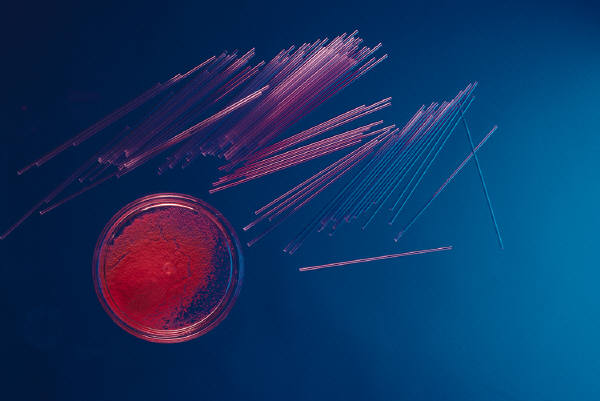 Cavity Causing Bacteria Linked to Lethal Heart Infection