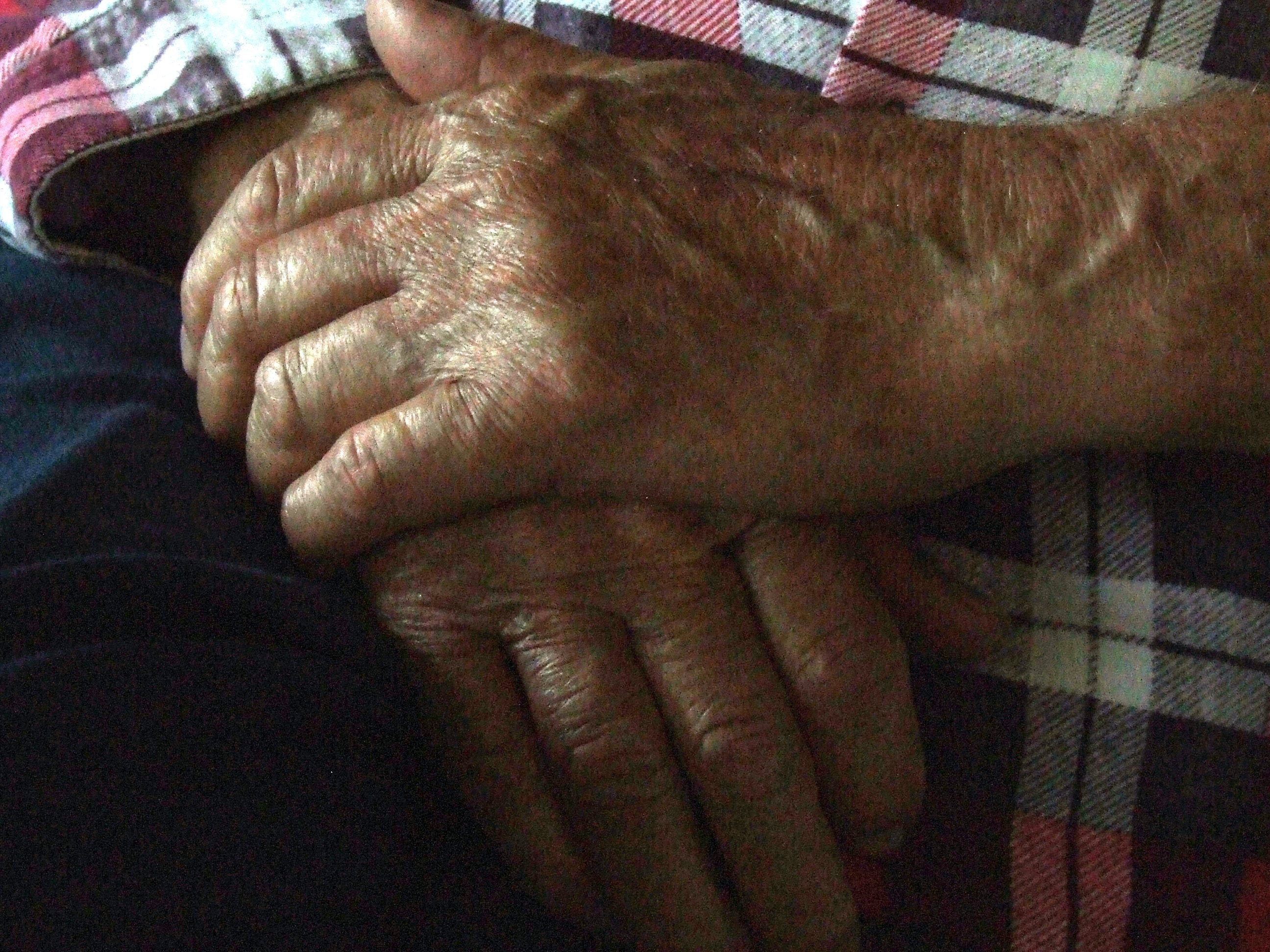 Arthritis Anxiety