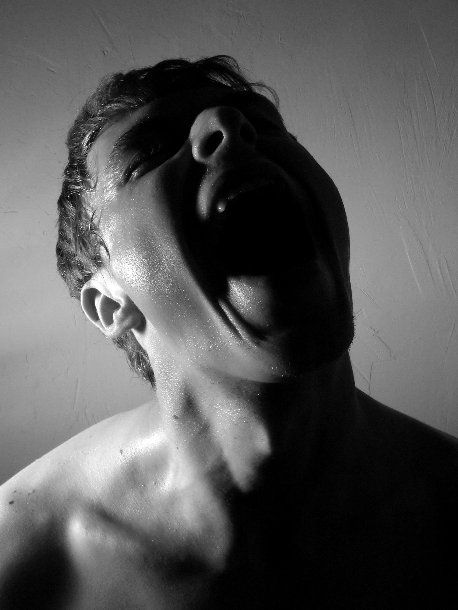 Depression, Anxiety and Your Risk of Stroke