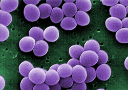 Acne Bacteria Not As Resistant