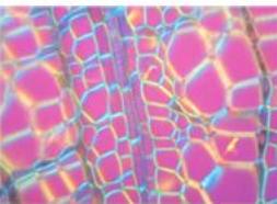 Anti-Inflammatory Drug Also an Anti-Cancer Drug?