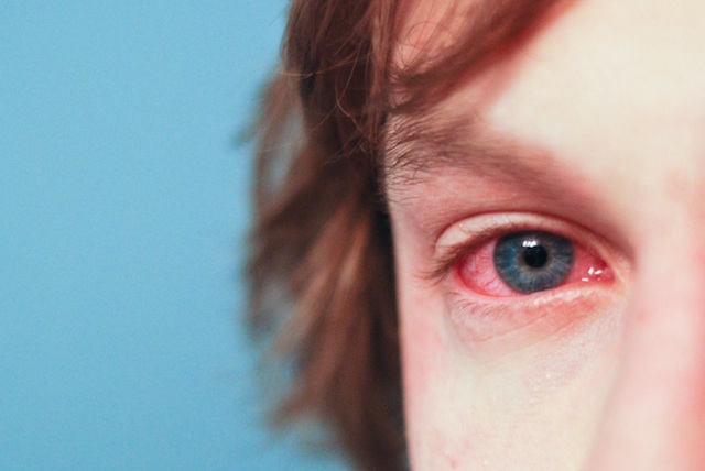 How are Allergies Linked to ADHD?