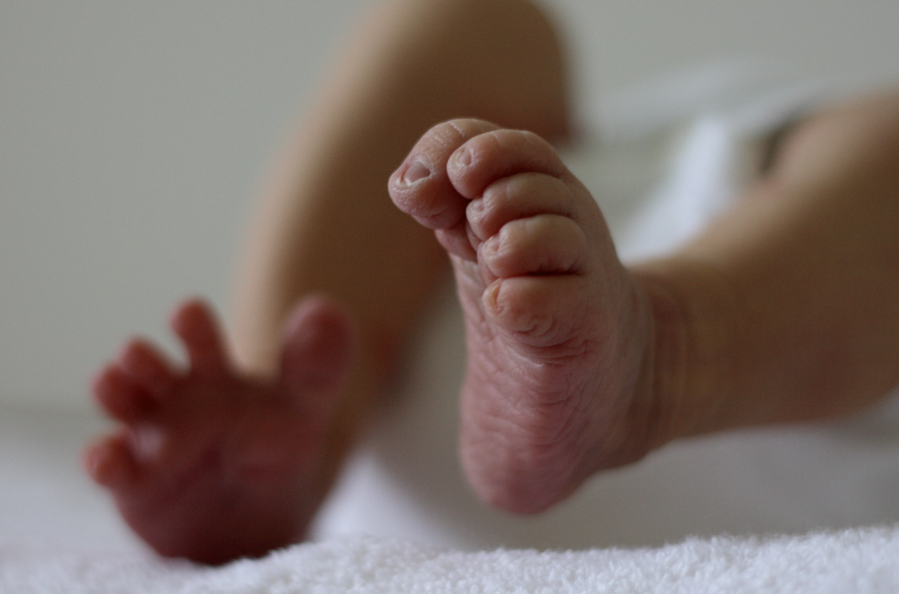 Preemies Increasing Worldwide