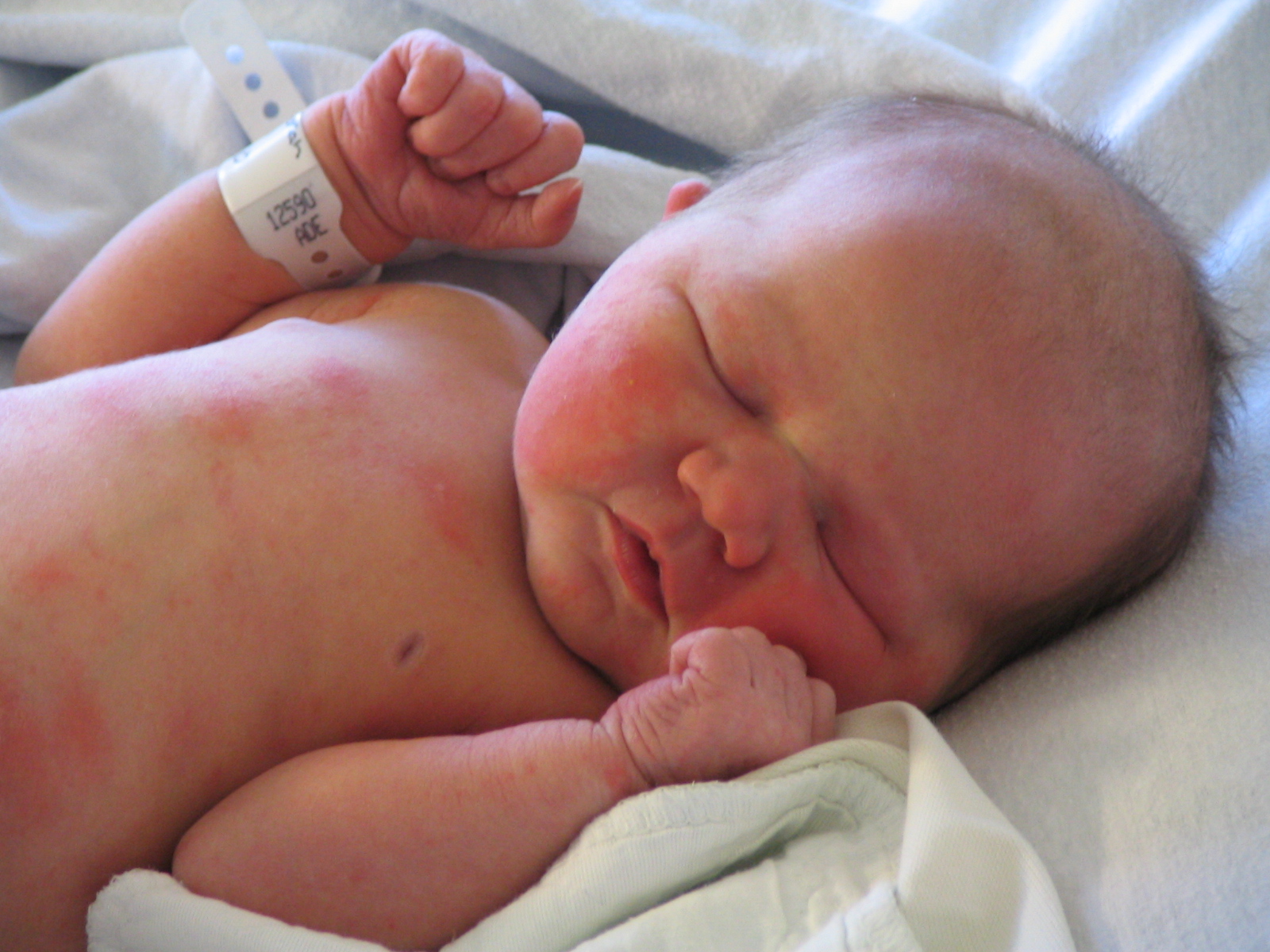 Preemie Birth Rate Drops in US