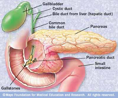 FDA Approves new Pancreatic Enzyme Products