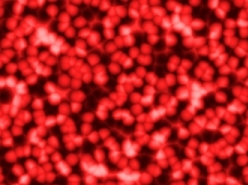 Calming the Cancer of Inflammation