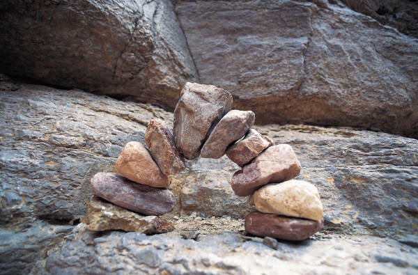 Got Stones, Need Kidneys