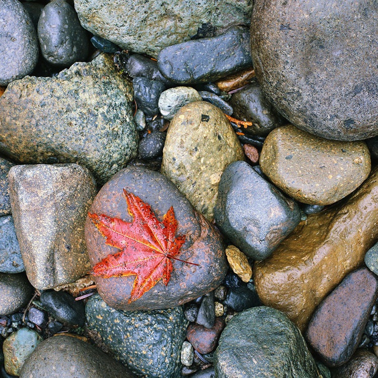 Kidney Stones Linked to ESRD