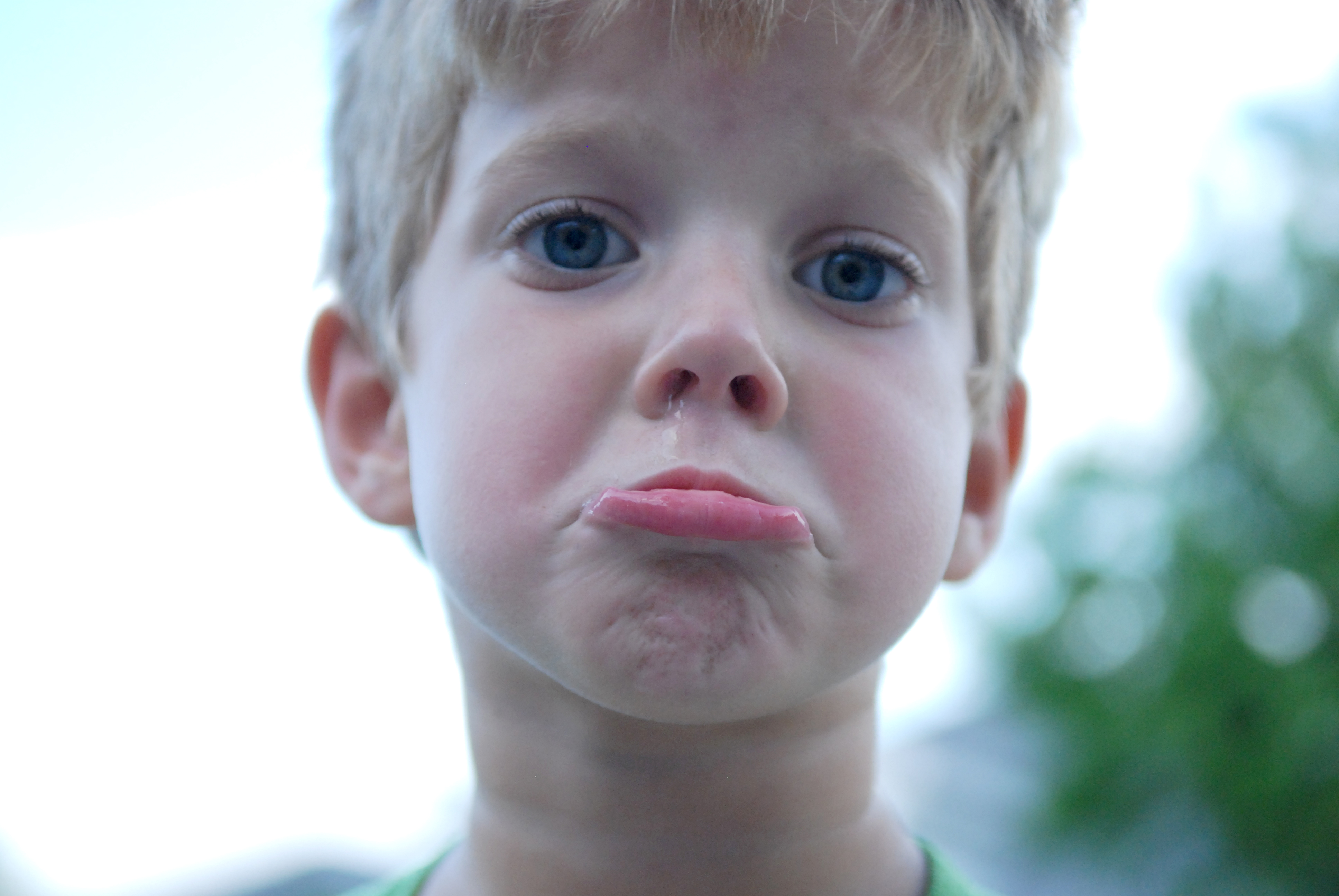 Child Abuse Hospitalizations Too High
