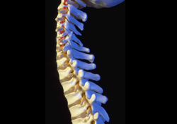 Multiple Sclerosis - Tricky, Unpredictable, Incurable