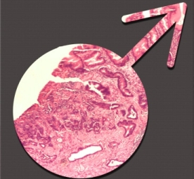 The Protective Effects of Estrogen