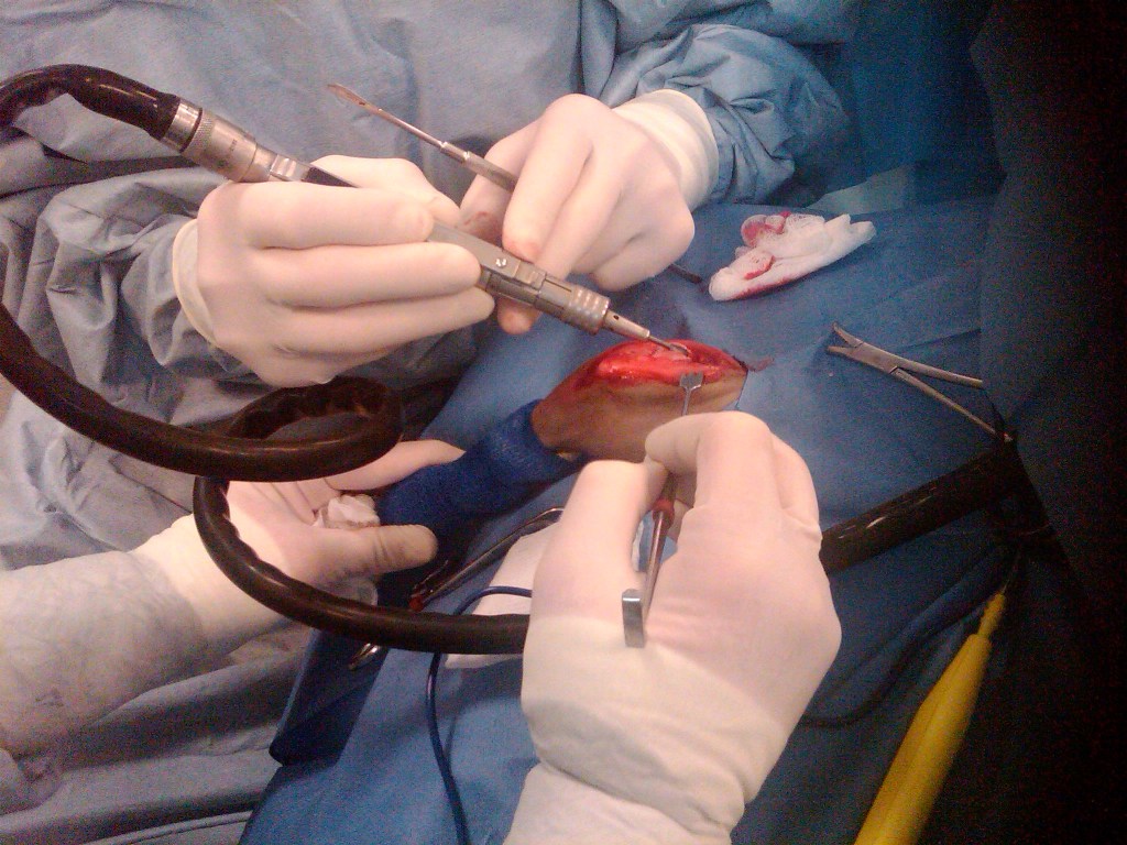 Fewer Cuts to the Gut