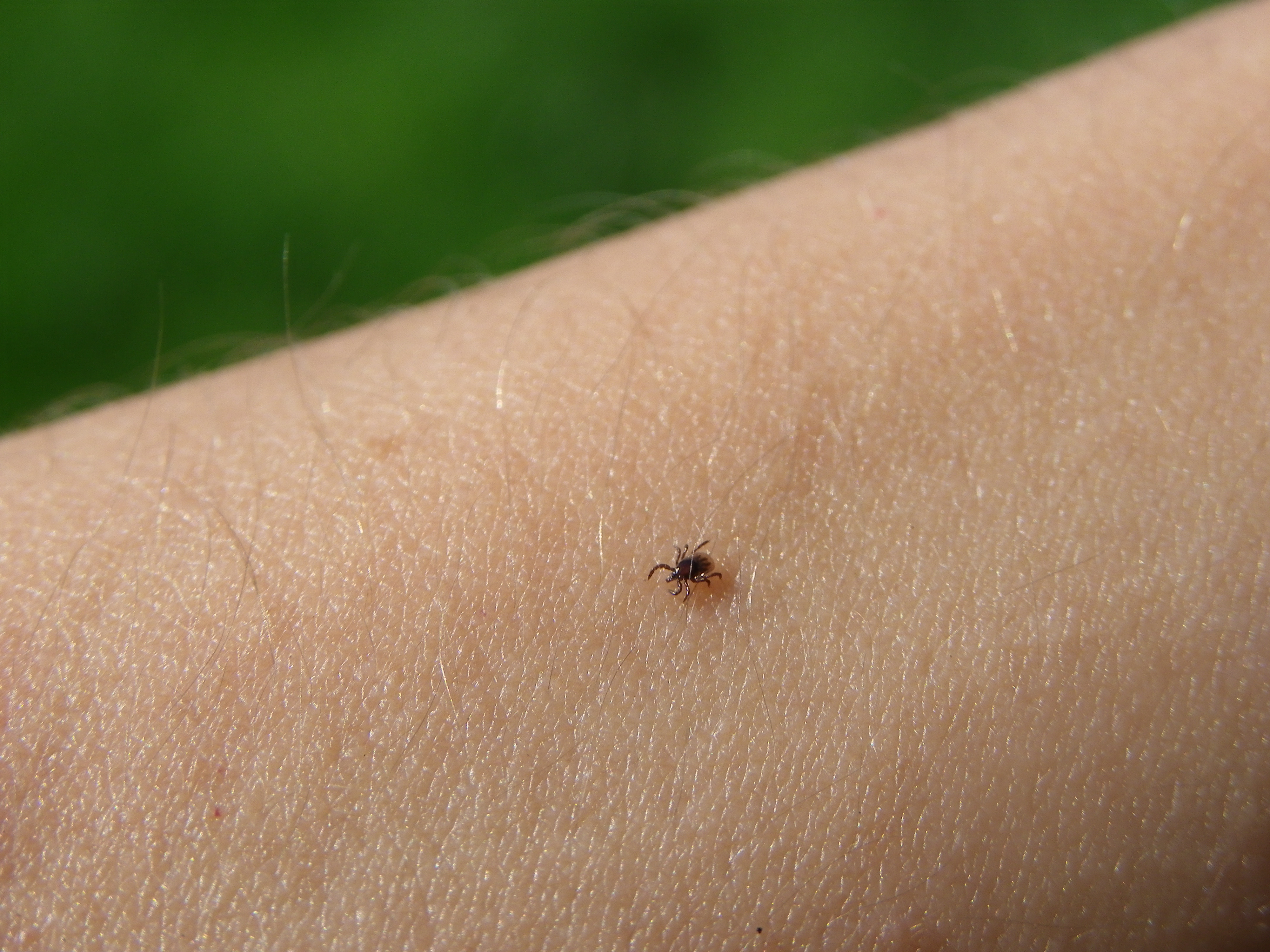 The Numbers on Lyme Disease