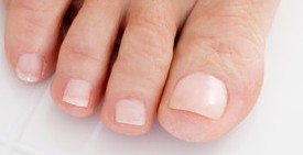 Telling Toenails