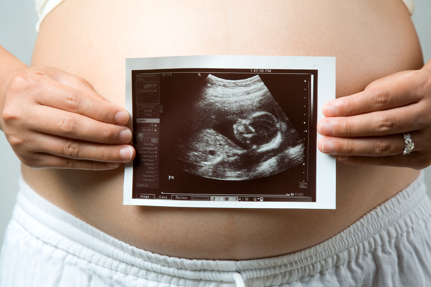 Early Delivery Decisions Should be 'Mom-focused'