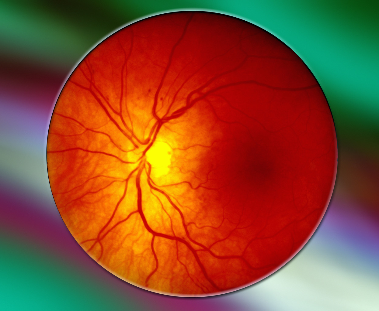 Leaking Blood Vessels May Cause Sepsis