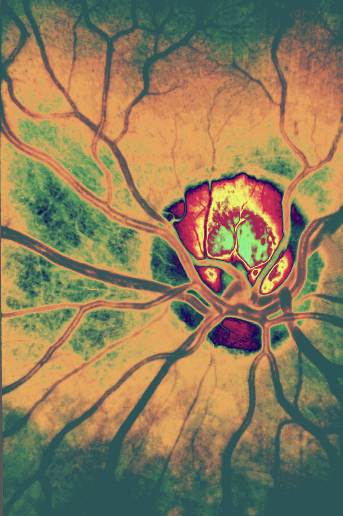 Partners in Vascular Crime