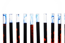 Finally, a Definitive Test for Alzheimer's