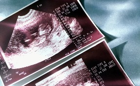 Dangerous Exposures to Unborn Children 