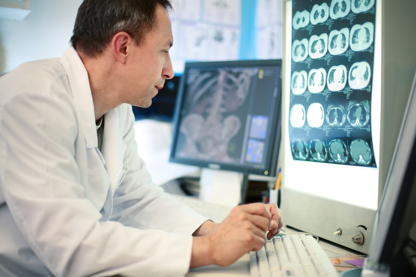 How Accurate Are Cancer Scans?