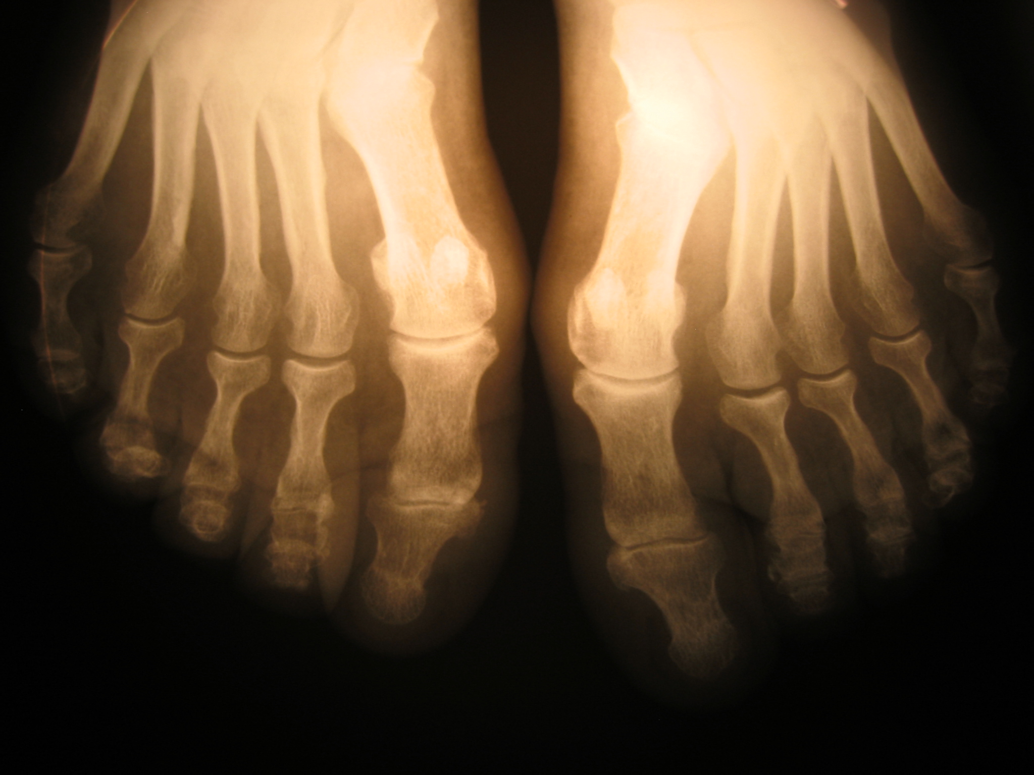 Good To The Bone
